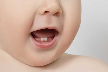 دندان در آوردن کودک,استفاده از ژل بی حسی برای دندان کودک,دندان کودک