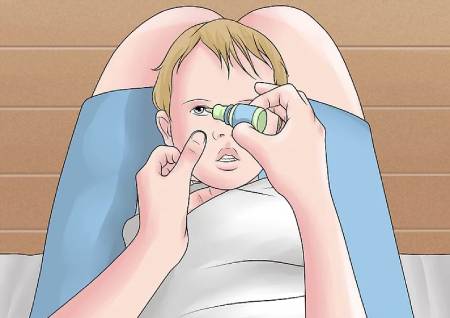 چکاندن قطره در چشم نوزاد,نحوه‌ی ریختن قطره چشمی نوزادان