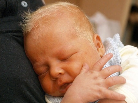 زردی در نوزادان تازه متولد شده, آزمایش بیلی روبین نوزاد, ازمایش زردی نوزاد با دستگاه