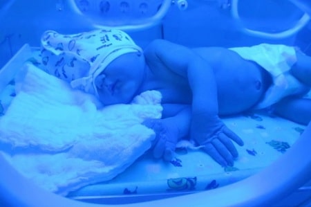  زردی در نوزادان تازه متولد شده, آزمایش بیلی روبین نوزاد, ازمایش زردی نوزاد با دستگاه